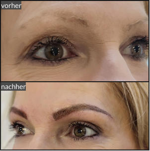 vorher nachher