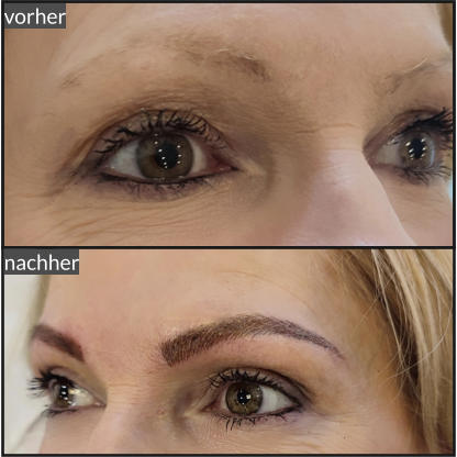 vorher nachher